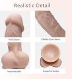 Lifelike Silicone Dildo for Masturbator, Realistic Dildo Real Penis with Strong Suction Cup, XTOY.US Big Thick Dildo Toys for Women Sex Pleasure ((Flesh))